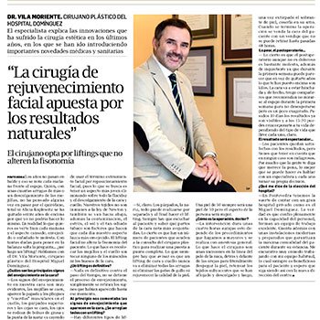 La cirugía facial apuesta por lo natural